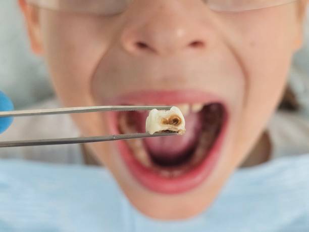 Best After-Hours Dental Trauma Care in Wetumka, OK